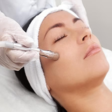 microdermabrasion in vienna va