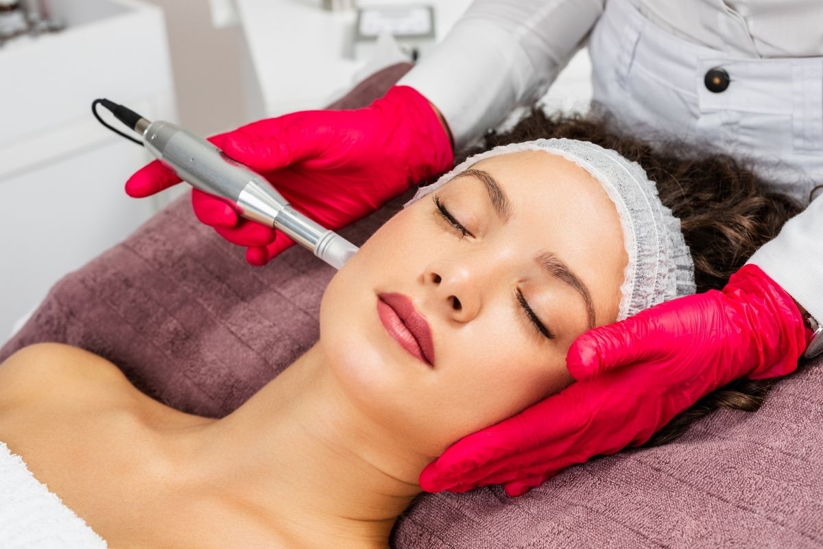 Microneedling in vienna va